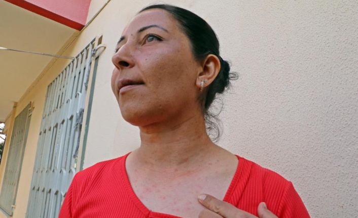 Evinin bahçesindeki tırtılları süpüren kadın, neye uğradığını şaşırdı | VİDEO HABER